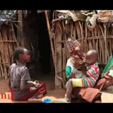 Bite for change